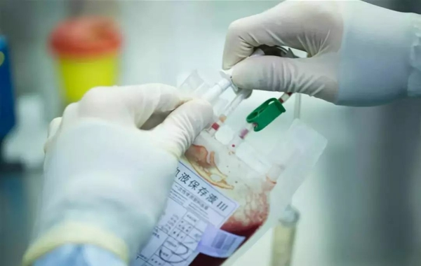 伤食泄泻证状特点有哪些