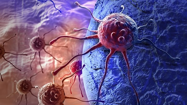 腰椎间盘突出会导致下肢放射性疼痛吗