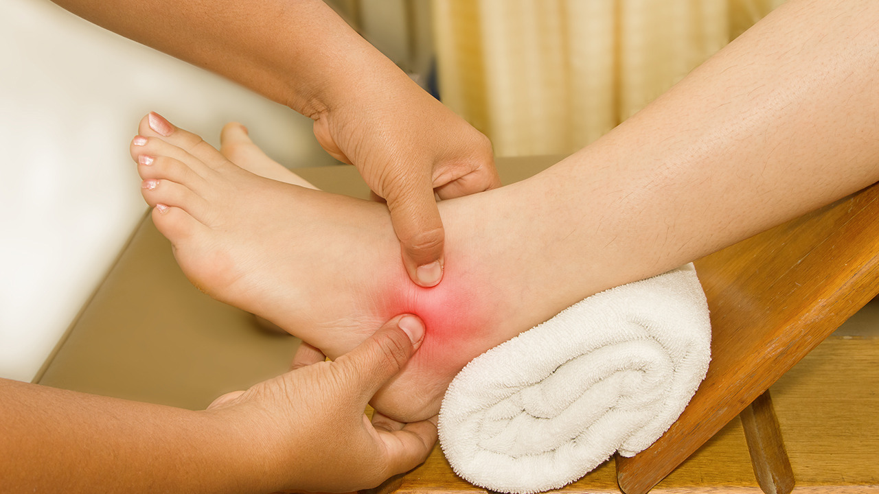 关节损伤属于什么伤害类型