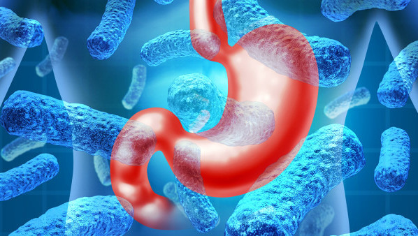 胃出血日常生活预防