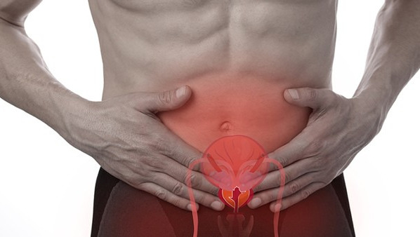 前列腺增生的注意事项有哪些