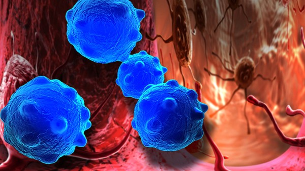 如何预防血管瘤破溃出血