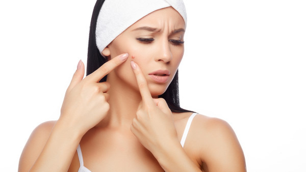 脸上老长痤疮怎么办