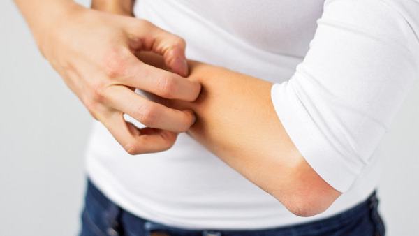 过敏性皮炎的临床症状