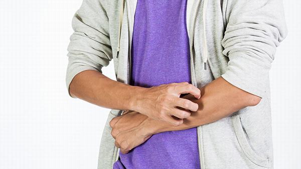 过敏性皮炎巨痒难忍影响睡眠吗