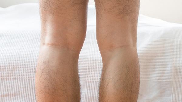 韧带损伤多久能恢复正常脚踝