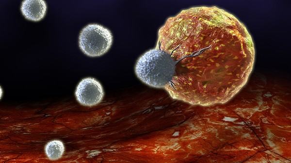 骨癌早期症状疼痛会在不同地方吗