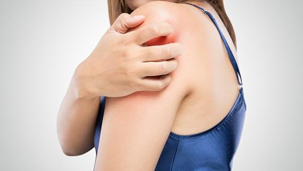 过敏性皮炎可自愈吗