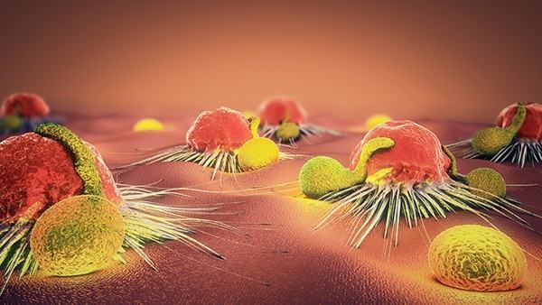 什么人容易得淋巴癌