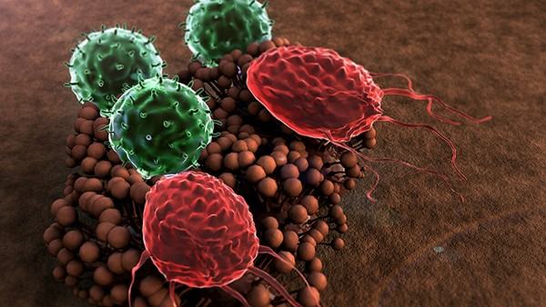 肝血管肉瘤如何消除