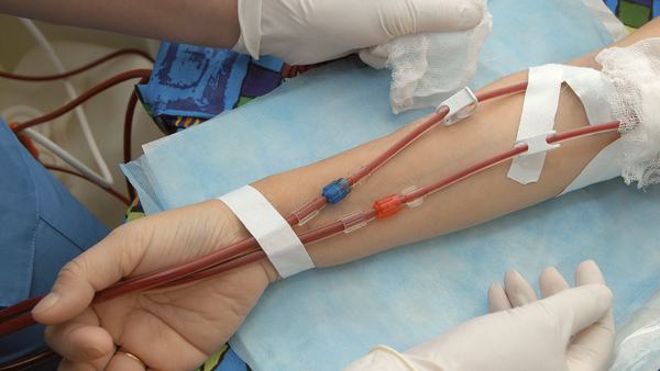 艾滋病前兆有哪些症状