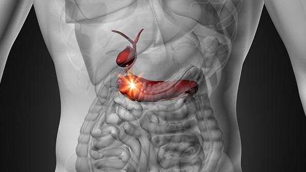 急性胰腺炎的特征性改变