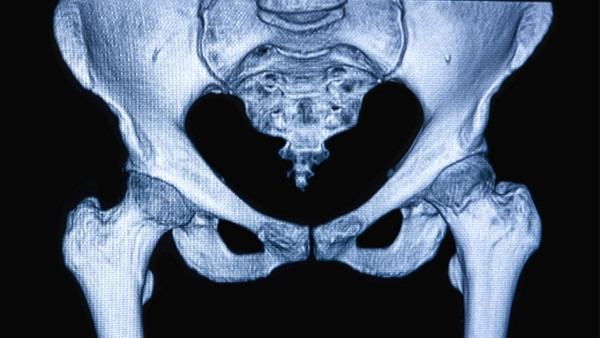 骶髂关节炎是哪个部位的症状