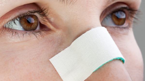 鼻息肉手术后有哪些不良症状