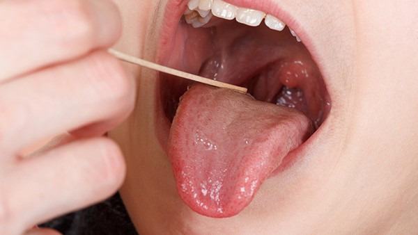 鼻咽囊肿会癌变吗