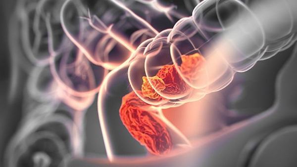 怀孕肠绞痛如何缓解