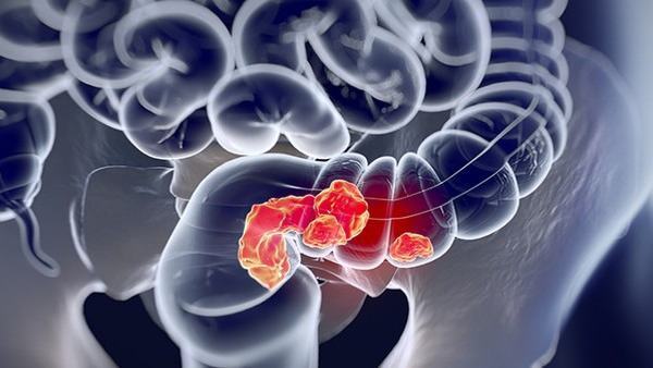 婴儿肠绞痛如何缓解疼痛