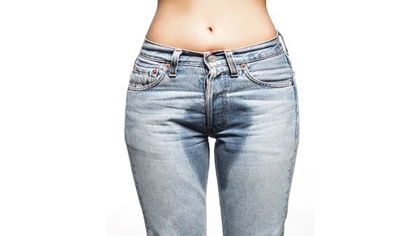 张力性尿失禁临床表现