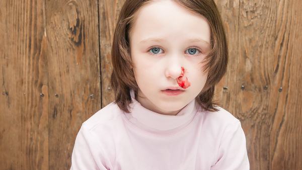 鼻出血常用的治疗方法是什么