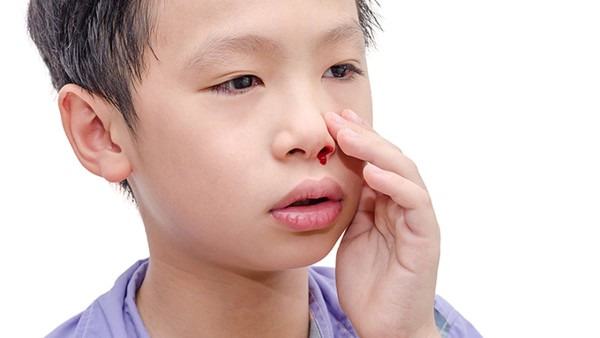 鼻出血的止血动作是什么