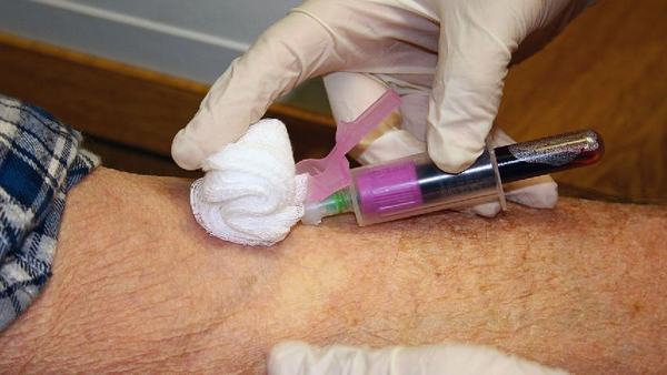 高脂血症的患者如何做护理工作