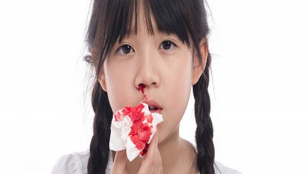 鼻出血的治疗原则及止血方法