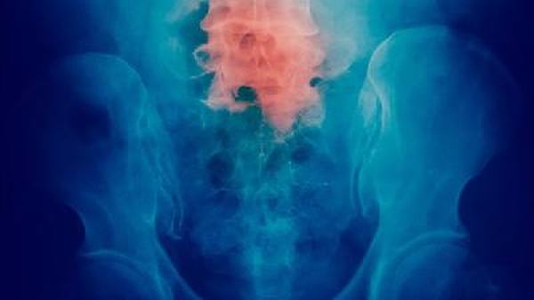 肺栓塞的日常护理应注意什么