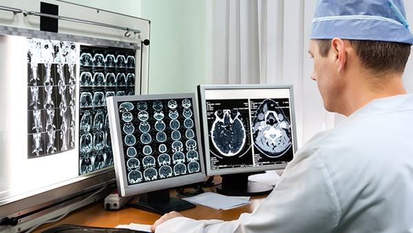 经常脑供血不足需警惕五大危害