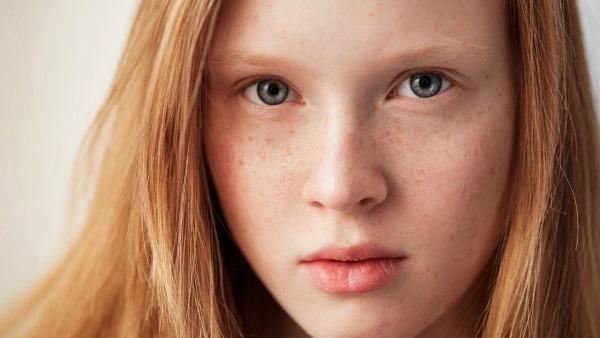 面瘫艾灸穴位有哪些