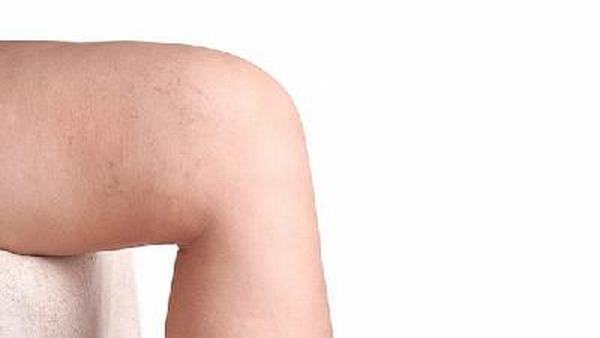 骨质疏松的日常护理主要有以下几个方面