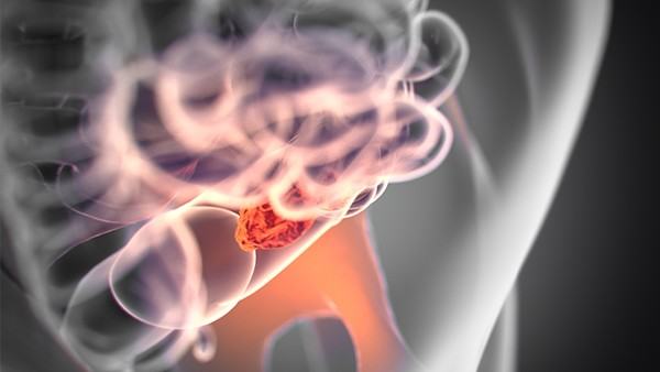 克罗恩病人如腹部疼痛等不适