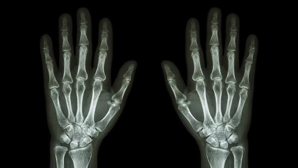 骨质疏松患者接受治疗前要结合其诊断