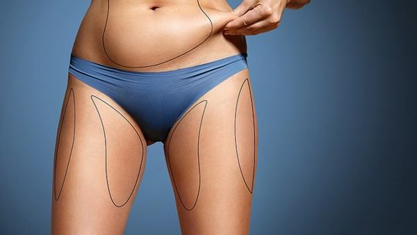 克罗恩病是传染病吗