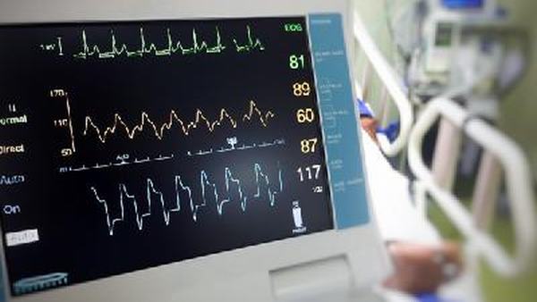 心律失常须做3个检查