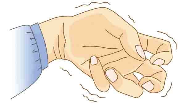 帕金森复发几率高吗