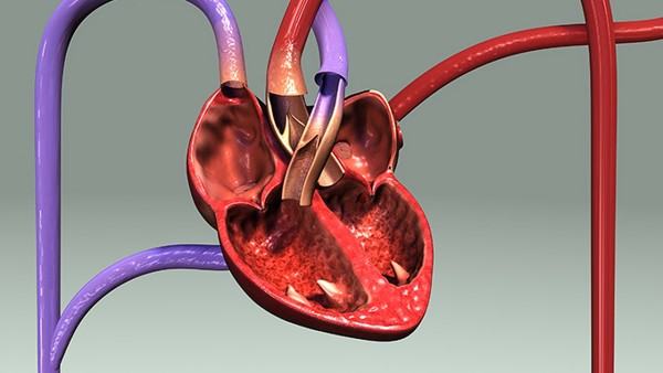 专家剖析具体的引起心律失常的原因