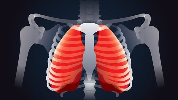 肺炎的分类有哪些