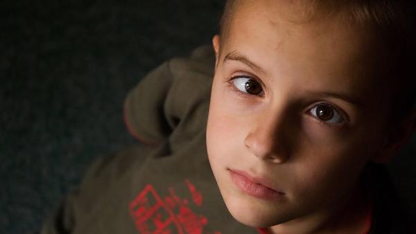 引起面瘫的主要原因是什么