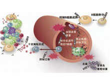 ANCA相关性血管炎