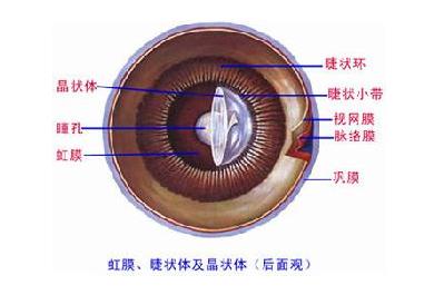 虹膜睫状体炎