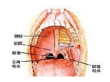 疱疹性咽峡炎