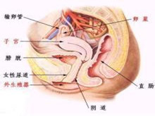 膀胱阴道瘘