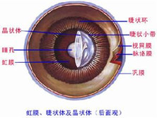 青光眼睫状体炎综合征