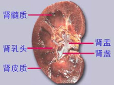 急性肾小球肾炎