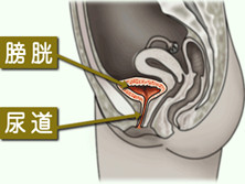 急性膀胱炎