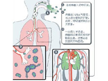 病毒性咽炎