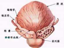 前列腺囊肿