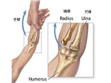 桡骨下端骨折