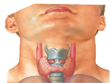 甲状腺囊肿