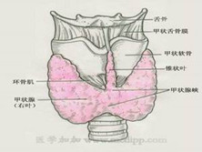 结节性甲状腺肿